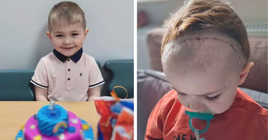 Trzyletni Kuba Kinder z Orzecha znów potrzebuje wsparcia. Malucha czeka zagraniczna operacja